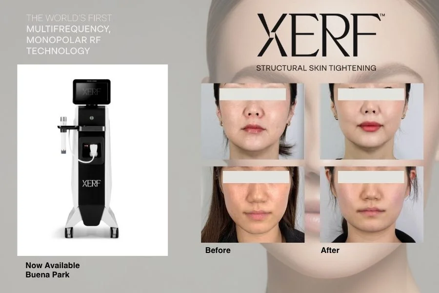 17 Medspa XERF Special
