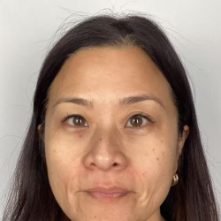 Derma-PRP Bio Filler Before & After Patient #2678